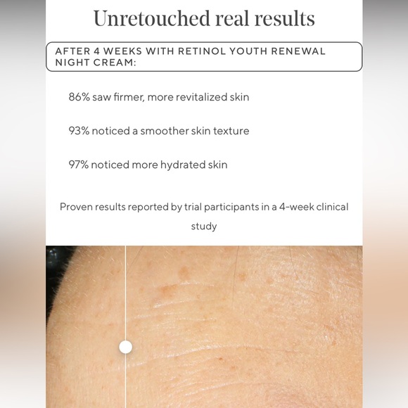 🌻Murad Retinol Youth Renewal Night Cream - Travel-sized - Picture 6 of 14